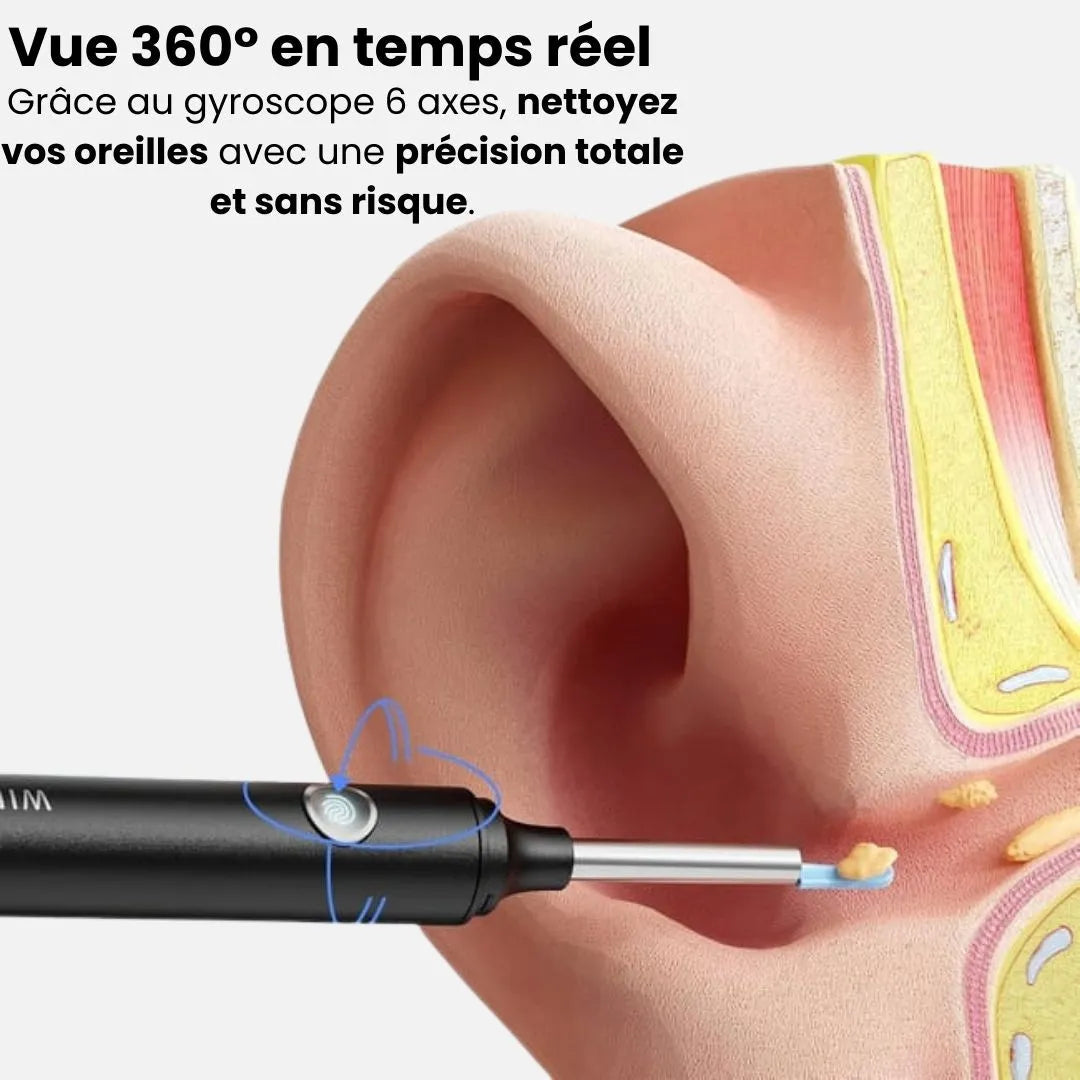 OryaleCam™ – Technologie médicale pour une audition parfaite